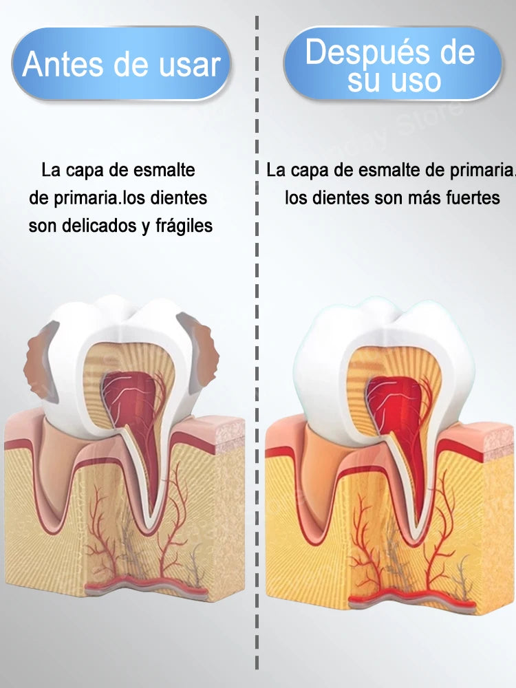 El fluoruro científico más vendido repara las cavidades, elimina las cavidades, limpia la placa, blanquea los dientes y refresca el aliento