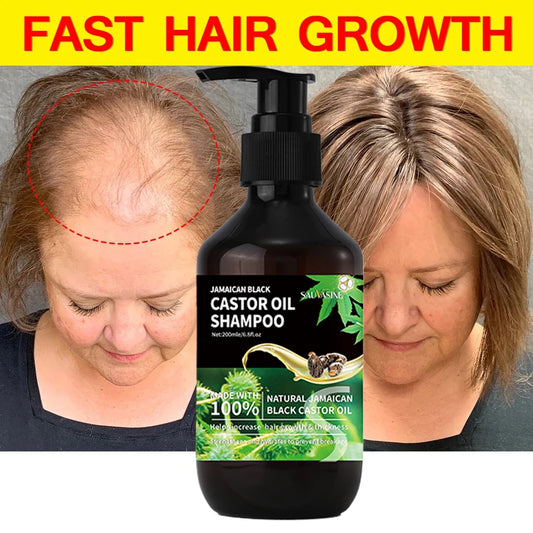Champú para el crecimiento del cabello unisex, de aceite de ricino