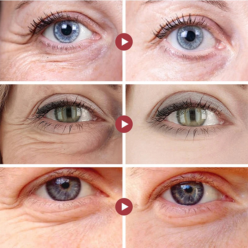 Crema antiarrugas para los ojos, palo de Retinol, elimina las ojeras hinchadas, levanta el área de los ojos