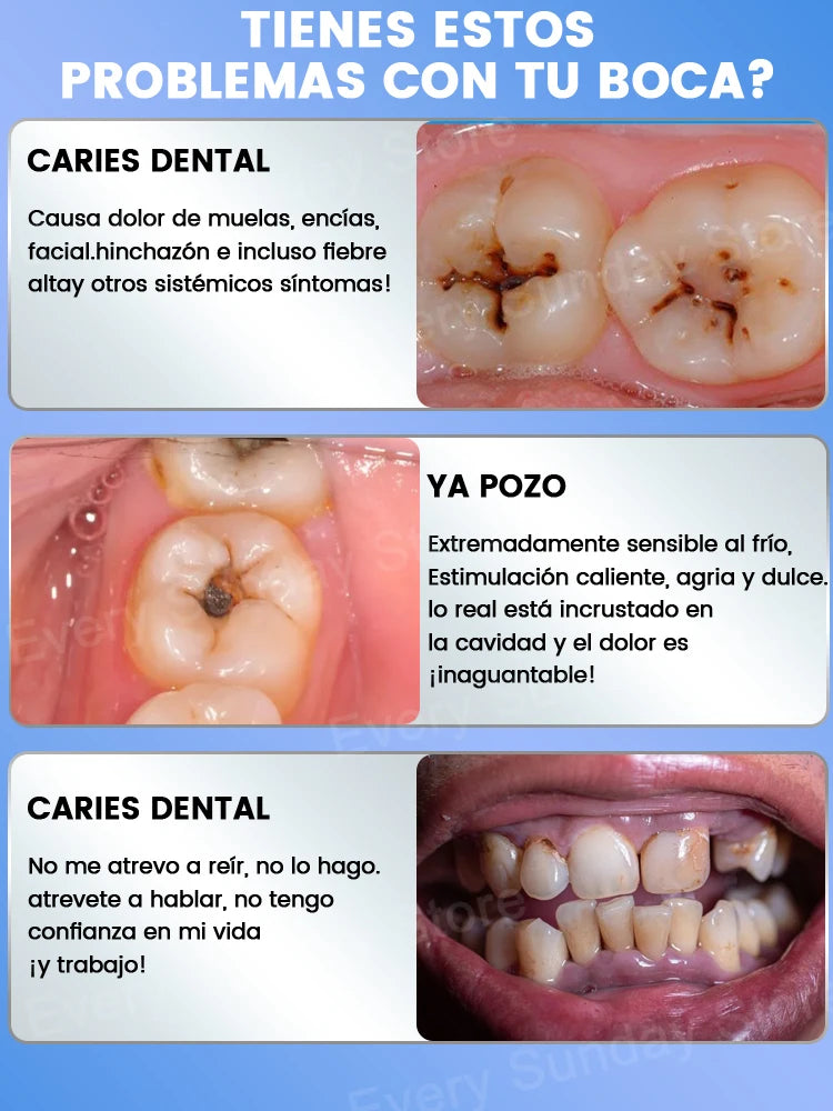 El fluoruro científico más vendido repara las cavidades, elimina las cavidades, limpia la placa, blanquea los dientes y refresca el aliento